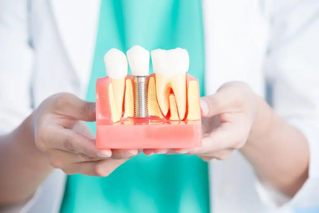 Implantes y Prótesis